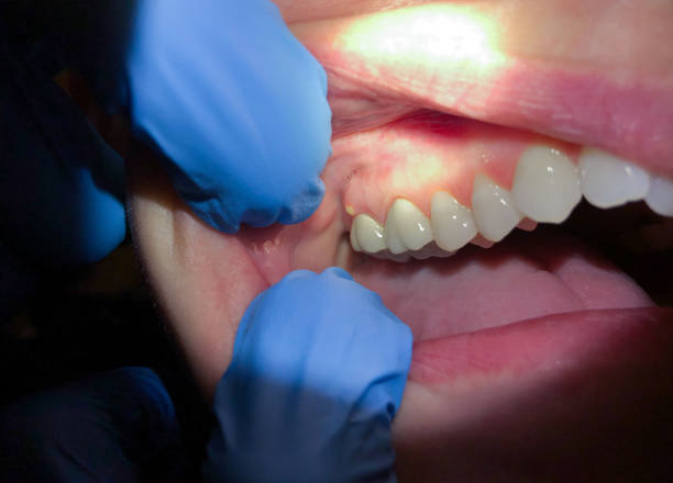 Best Emergency Dentist for Special Needs Patients in West Ishpeng, MI