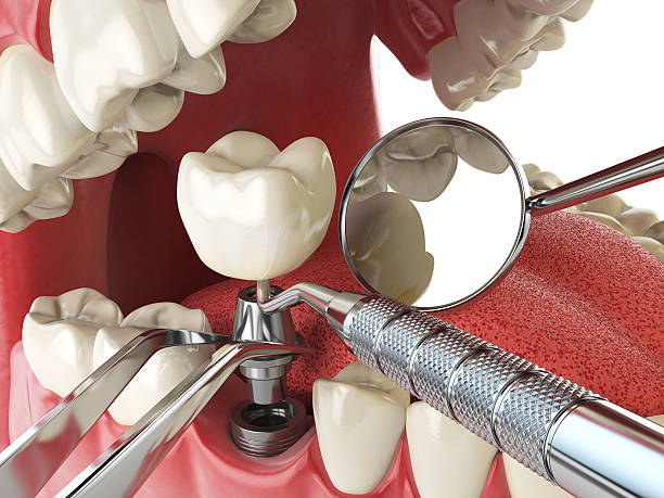 Best Emergency Dental Services for Seniors in West Ishpeng, MI