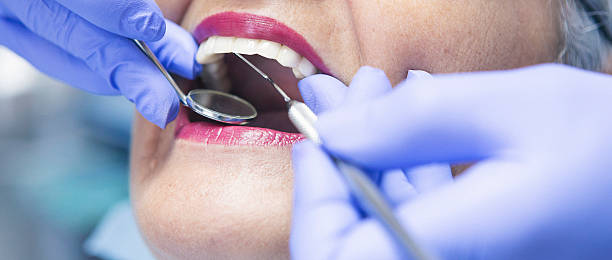 Best Holiday Emergency Dentist in West Ishpeng, MI
